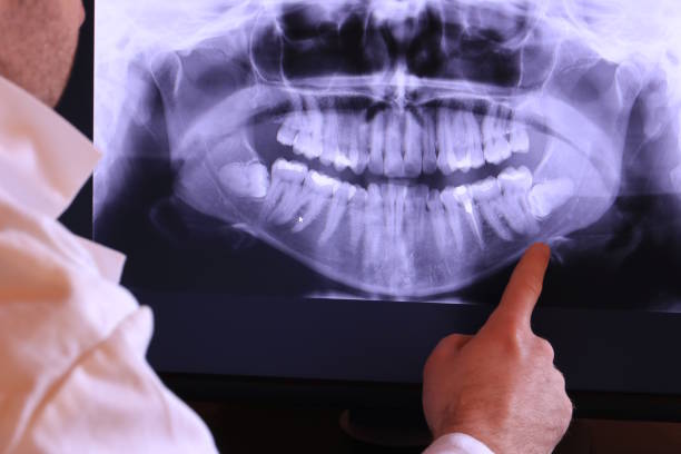 Best Emergency Treatment for Oral Infections in Winslow, AZ