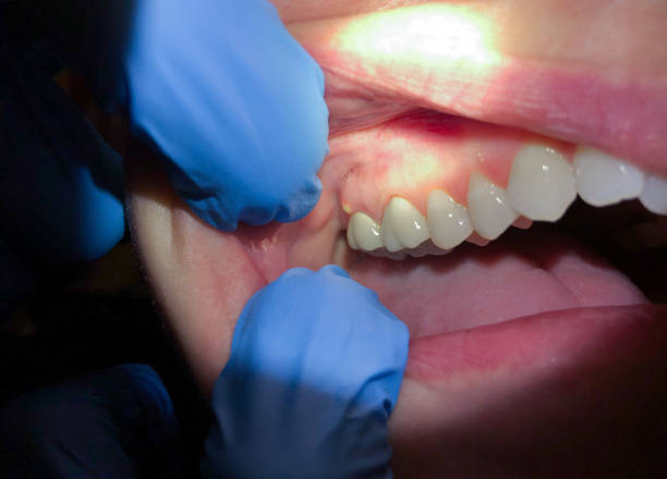 Best Emergency Treatment for Jaw Pain or Injury in Winslow, AZ