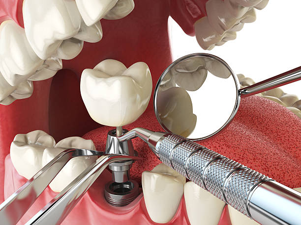 Best Emergency Denture Repair in Winslow, AZ